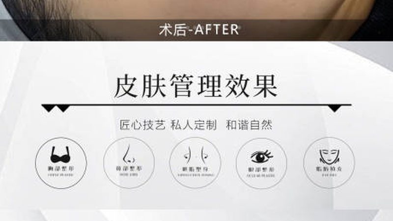 面部提升：线雕与注射，哪种方式更适合你？**