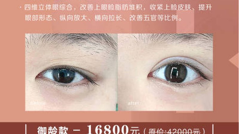 激光美容后红肿怎么处理