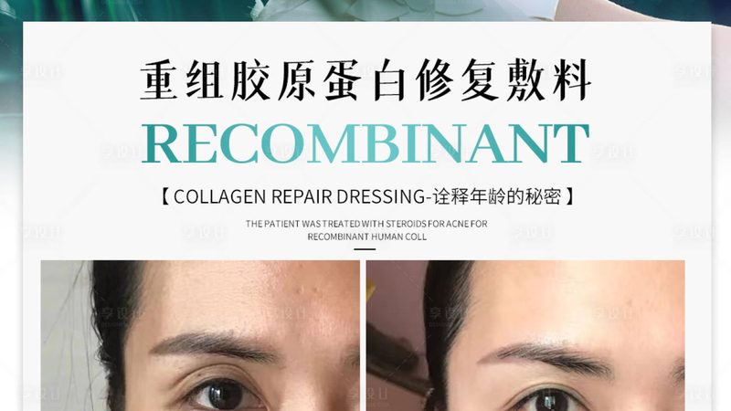 敏感肌适用家用光子嫩肤仪吗？揭秘家用光子嫩肤仪的真相