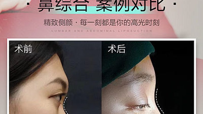 轻医美与整形：风险对比解析