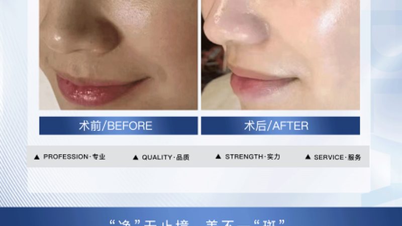 成都医美咨询师话术培训公司