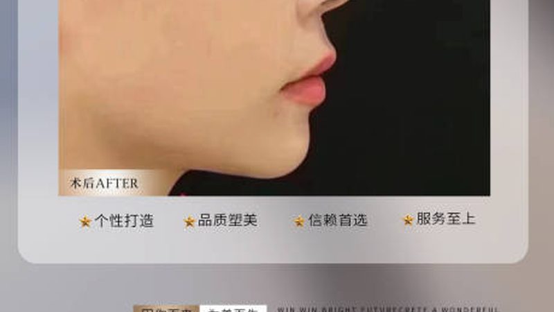 激光祛斑与皮秒激光：揭秘两者之间的差异