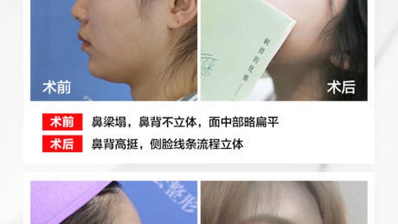 岁女性抗衰，运动之外的秘密武器