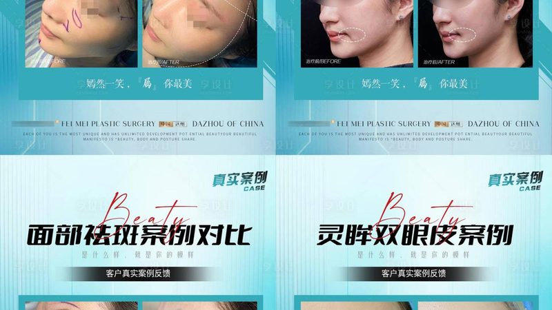 脱毛后，身体乳的使用之道**