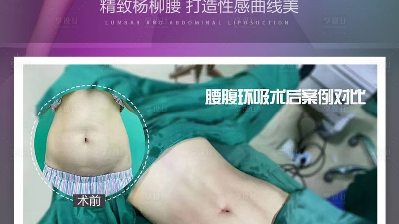 医美咨询到手术：揭秘完整流程，安全塑美第一步
