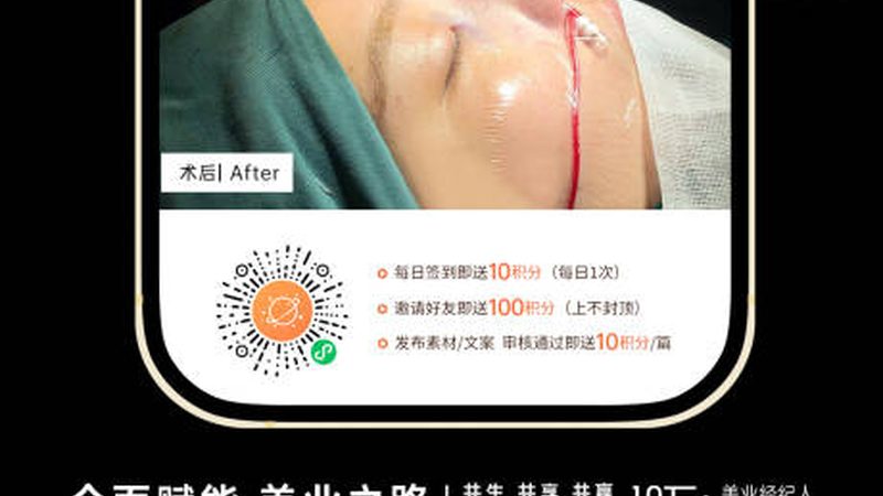 医美咨询师私域运营话术：如何精准触达目标客户