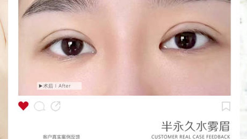 医美咨询师报价表，揭秘行业“标价”背后的秘密