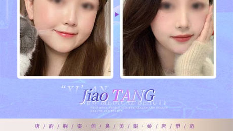 激光美容一次效果显著吗？揭秘激光美容的真相