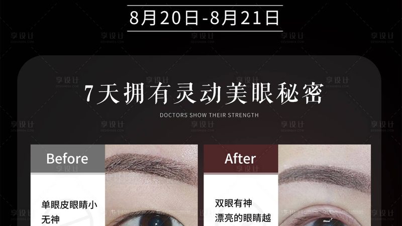 热玛吉手术，医生操作标准揭秘