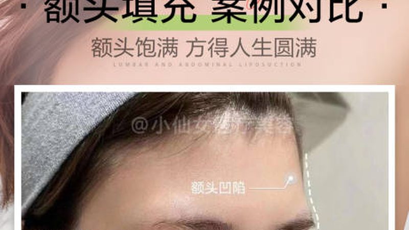 激光美容可以永久去毛吗